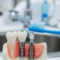Best ways to care for your dental implants