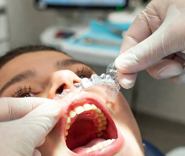 Invisalign Treatment